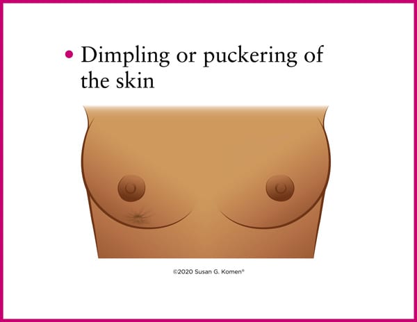 A Guide to Check for Bumps, Lumps and Other Changes in Your