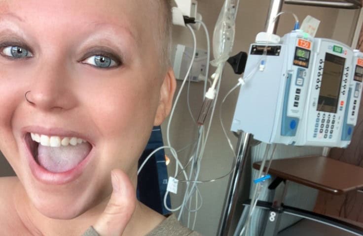 Casey is hooked up to a machine in a hospital room, receiving chemotherapy. She is bald and smiling, giving a thumb's up.