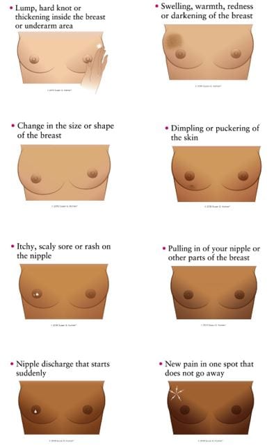 Rash between breasts?